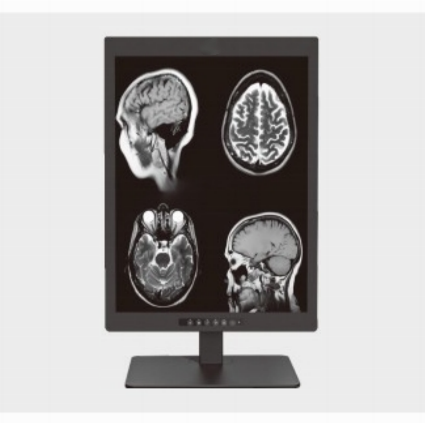 Missä 20,1 tuuman 2 megapikselin lääketieteellistä diagnostiikkanäyttöä käytetään yleisesti?