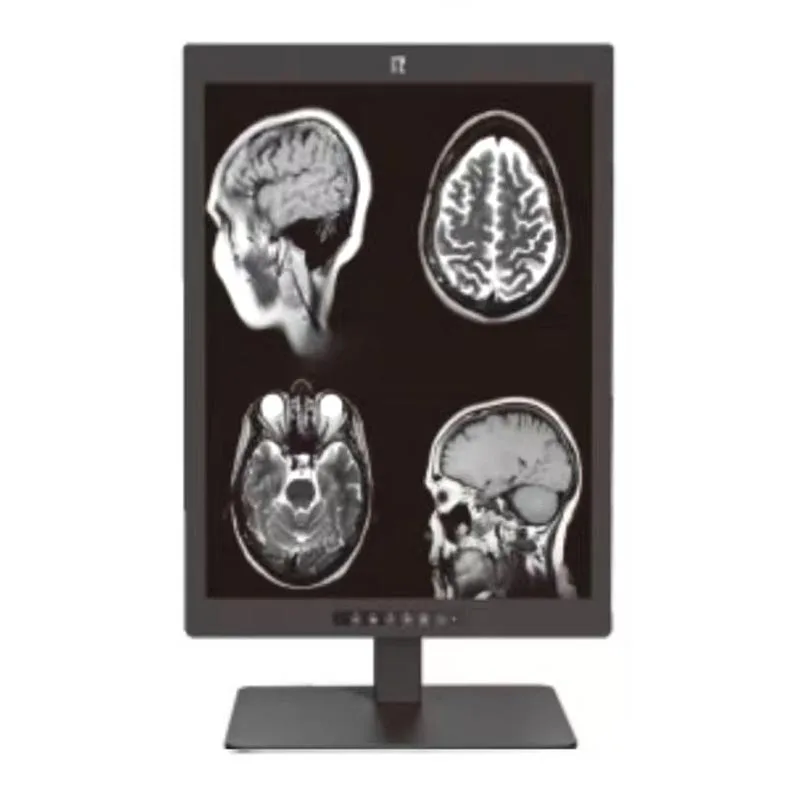 21,3 tuuman 3 megapikselin lääketieteellinen diagnostiikkanäyttö