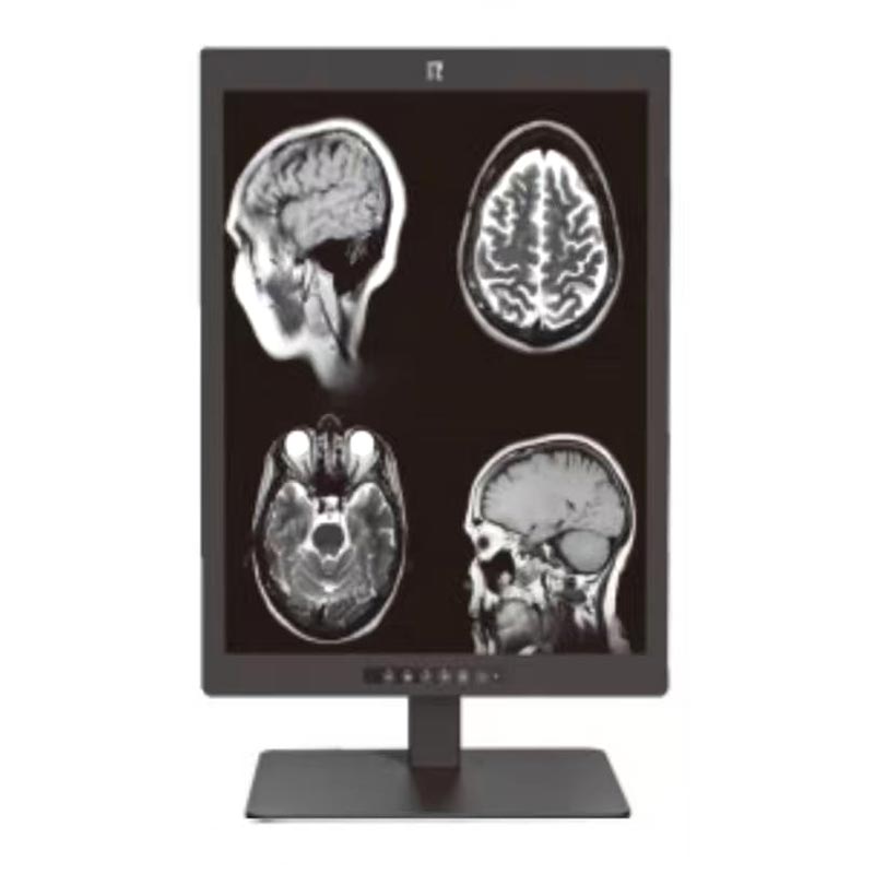 21,3 tuuman 3 megapikselin lääketieteellinen diagnostiikkanäyttö