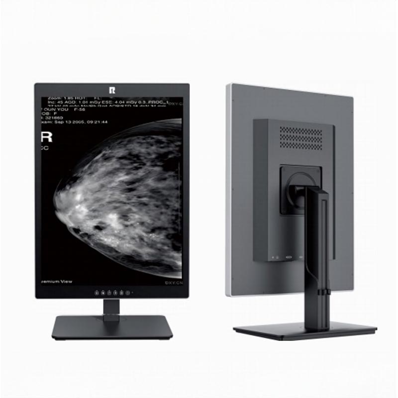 21,3 tuuman 5 megapikselin lääketieteellinen diagnostiikkanäyttö