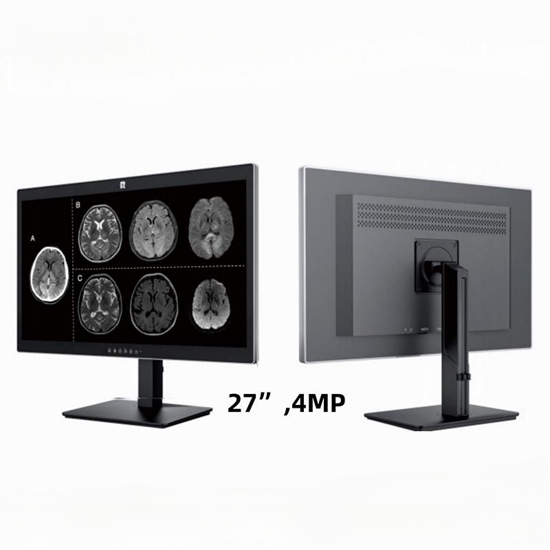 27 tuuman 4 megapikselin lääketieteellinen diagnostiikkanäyttö
