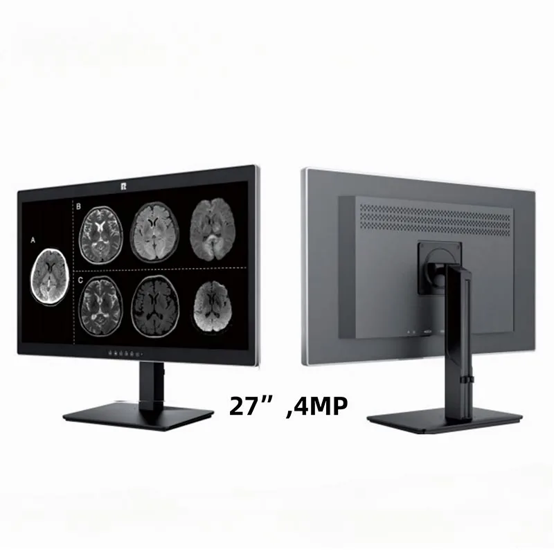 27 tuuman 4 megapikselin lääketieteellinen diagnostiikkanäyttö
