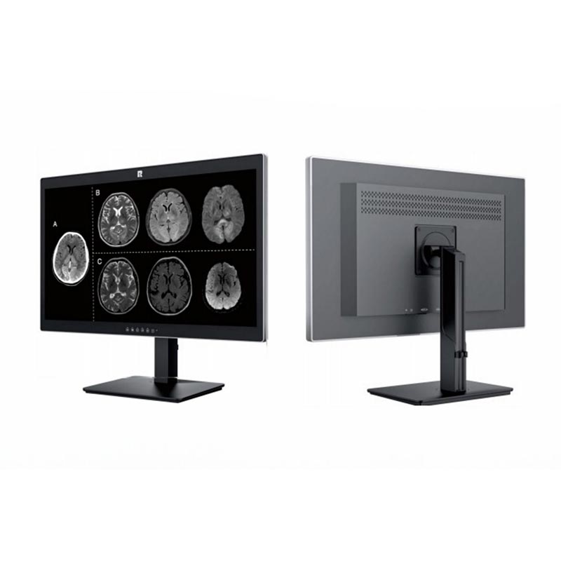 27 tuuman 8 megapikselin lääketieteellinen diagnostiikkanäyttö