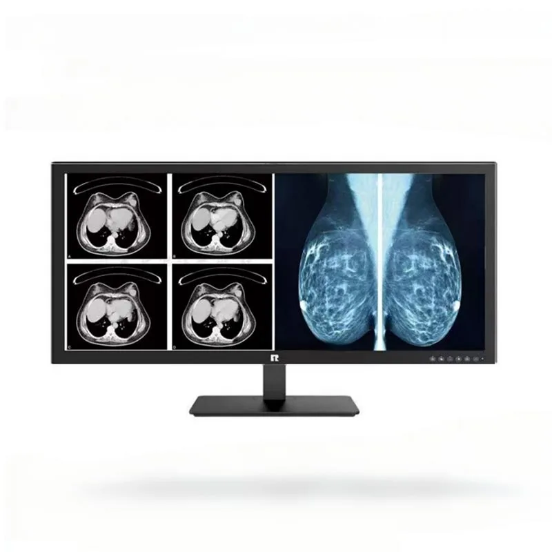 34 tuuman 5 megapikselin lääketieteellinen diagnostiikkamonito