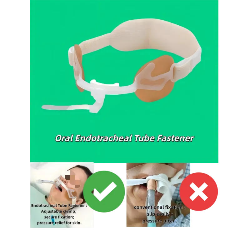 Endotrakeaaliputken kiinnike