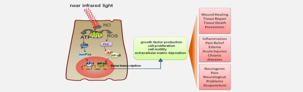 Low Level Laser Stimulation