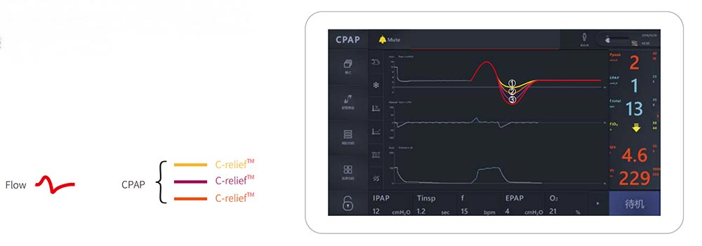 Ward and Surgical Medical Ventilator