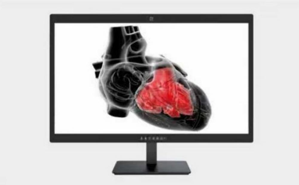 32-inch 8MP Medical Diagnostic Display