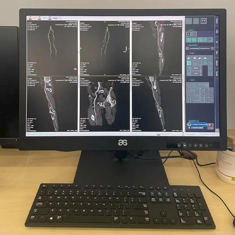 20.1-inch 2MP Medical Diagnostic Display