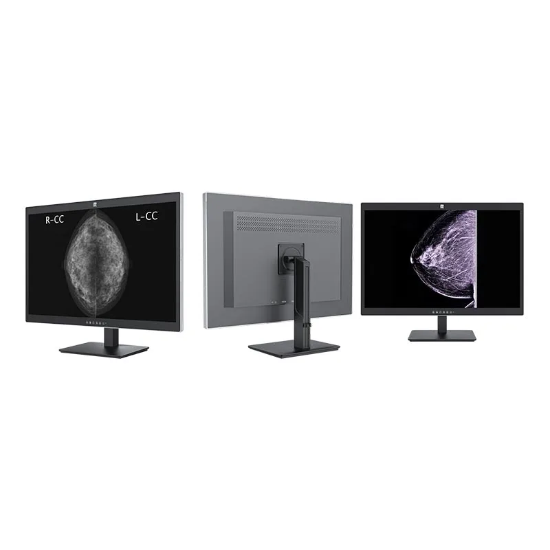 30-inch 6MP Medical Diagnostic Display